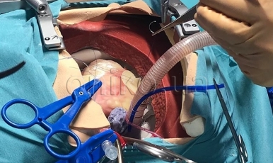NOVINKA // Vysoce realistický trenažér kardiohrudní chirurgie