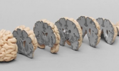 NEW // Human Brain Multiple Frontal Sections