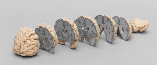 NEW // Human Brain Multiple Frontal Sections