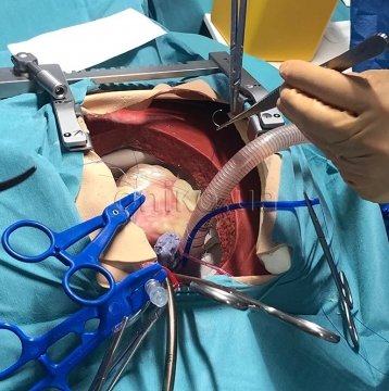 Високореалістичний тренажер кардіоторакальної хірургії (High-Fidelity CT Surgical Trainer)