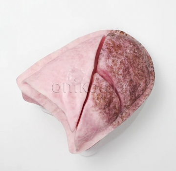 Повнорозмірне змінне легене для тренажера відеоасистованої торакоскопії