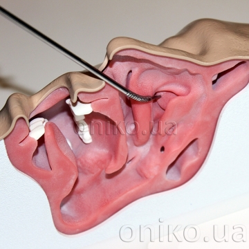 Отоларингологія