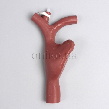 Праве передсердя з можливістю канюляції для ЕКМО (екстракорпоральна мембранна оксигенація)