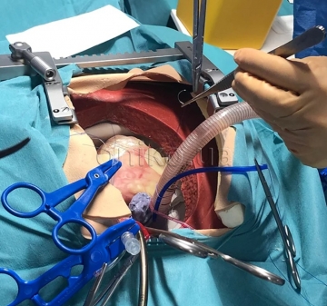 Високоточний кардіоторакальний хірургічний тренажер