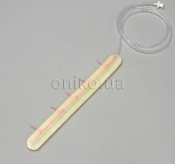 Високоточна ліва внутрішня грудна артерія (LIMA)