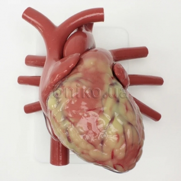 Збільшене серце дорослого (з просвітом судин)