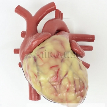 Найбільше серце дорослого