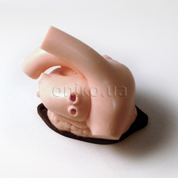 Мітральний клапан із передсердями