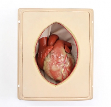 Портативна модель грудної клітки (формат валізи)