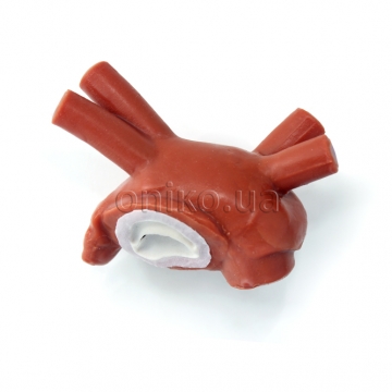 Нормальний мітральний клапан без хорд і папілярних м’язів