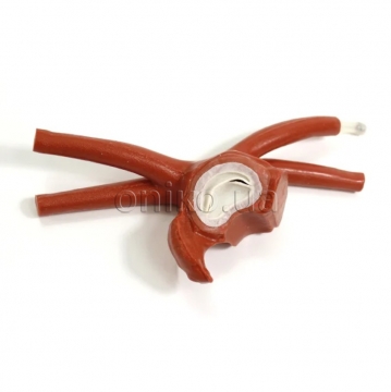 Збільшене ліве передсердя дорослого пацієнта з нормальним мітральним клапаном для малоінвазивної кардіохірургії