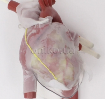 Перикард з плеврою