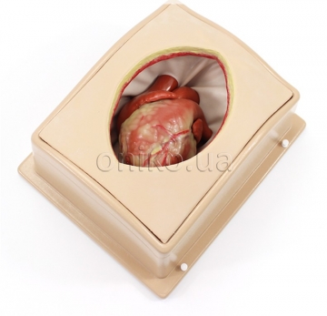 Грудна клітка у валізі