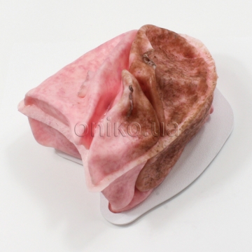 Змінна колабована легеня для тренажера відеоасистованої торакоскопічної операції