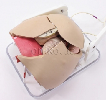 Кардіоторакальна хірургія