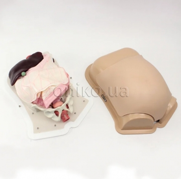 Роботизована хірургія