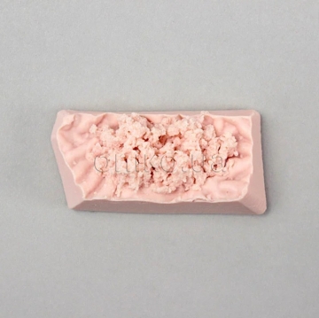 Біопсійний диск шлунка (тканина)