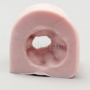 Кишкова тканина зі стриктурою