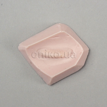 Тканина з варикозним розширенням вен стравоходу