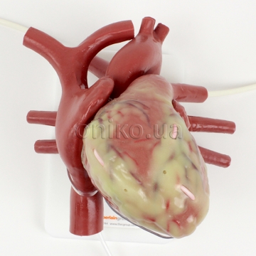 Канюльоване велике серце, що б’ється
