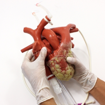 Канюльоване велике серце