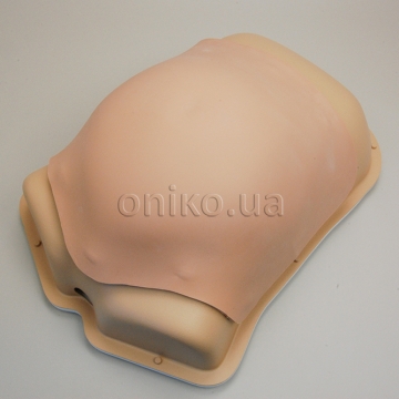 Просунутий шкірний модуль для лапароскопічної грижі AST