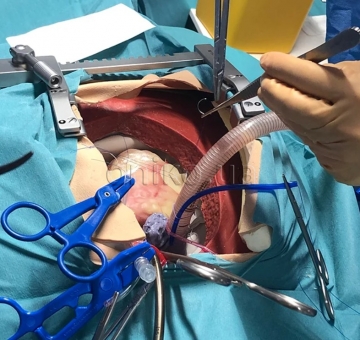 Кардіоторакальний хірургічний тренажер високої точності