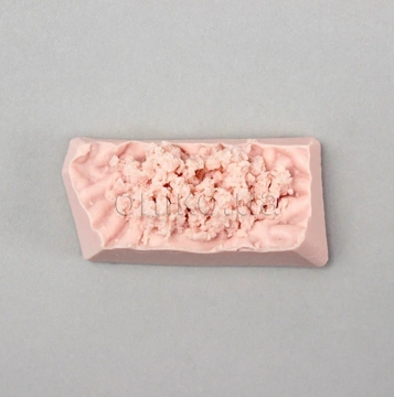 EMS біопсійний диск для шлунка