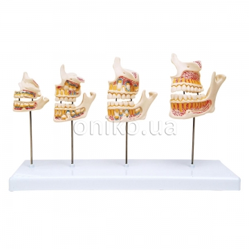 Dentition Development Model