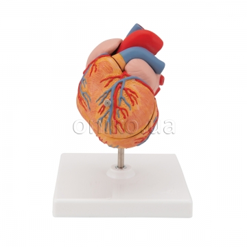 Classic Human Heart Model with Left Ventricular Hypertrophy, 2 part