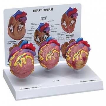 3-Mini Heart Set