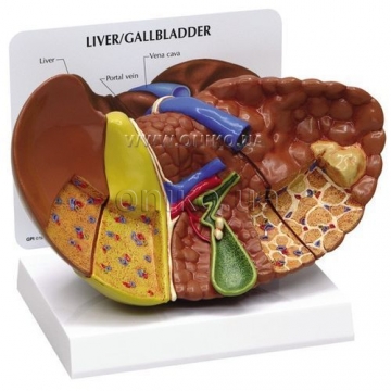 Liver with pathologies