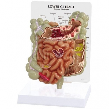 GI tract