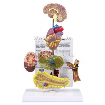 Metabolic syndrome