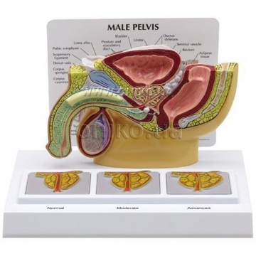 Male pelvis with 3D Prostate Frame