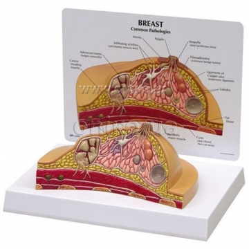 Breast Cross-Section