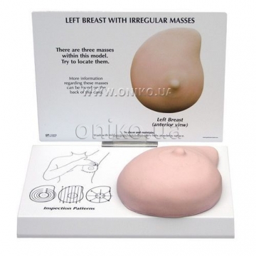 Left breast with irregular masses