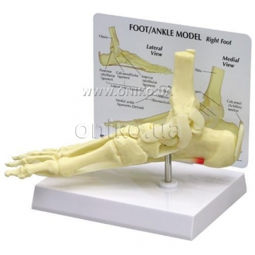 Foot/Ankle – Plantar Fasciitis