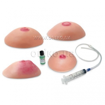 Common Breast Conditions Replicas