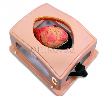 Кейс для серця