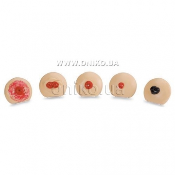 Ostomy Care Training Models Set