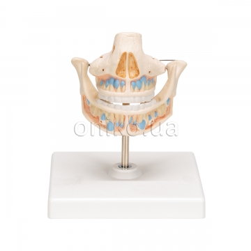 Milk Denture Model with Remaining Teeth