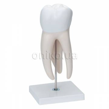 Giant Molar with Dental Cavities Human Tooth Model, 15 times Life-Size, 6 part