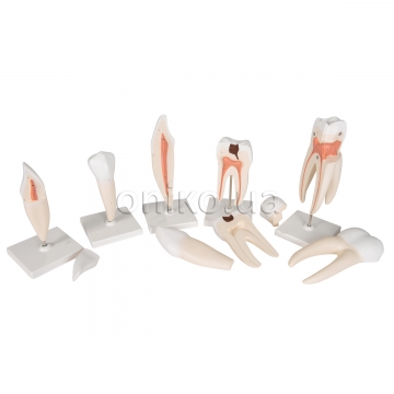 Human Tooth Models Set, 5 Models
