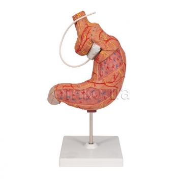 Gastric Band Model