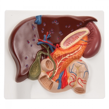 Модель печінки з жовчним міхуром і  підшлунковою залозою