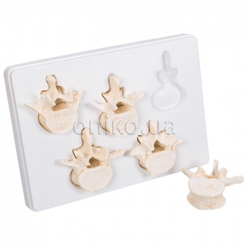 Set of 5  Lumbar Vertebrae