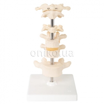 Model of 6 Human Vertebrae, Mounted on Stand