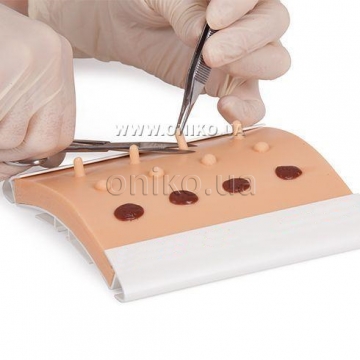 Curettage, Snip & Shave Excision Pad