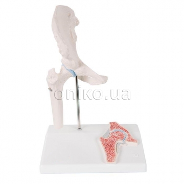 Mini Human Hip Joint Model with Cross Section